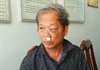 Kon Tum:  Phóng viên VTV bị hành hung phải nhập viện