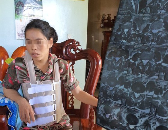 Quảng Bình: Khởi tố người chồng hành hung vợ suốt 11 năm